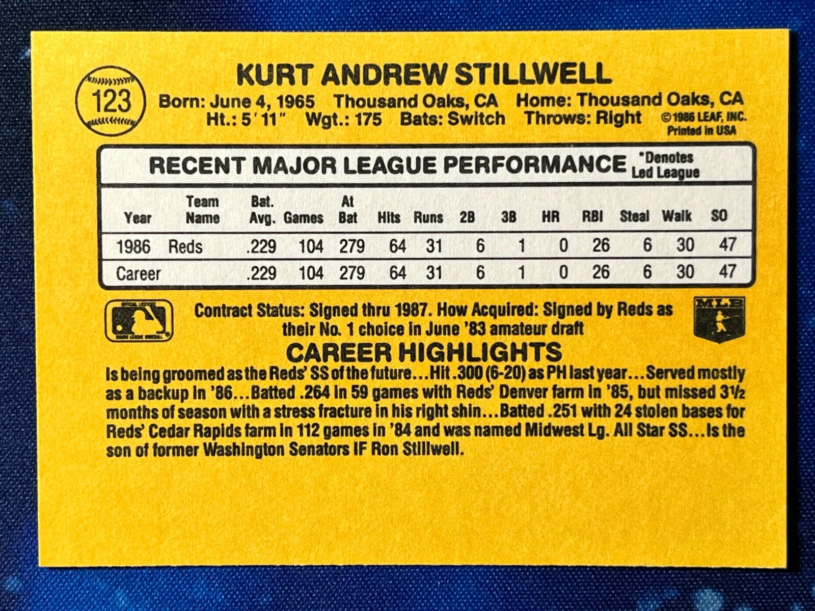 1987 Donruss #123 Kurt Stillwell Cincinnati Reds